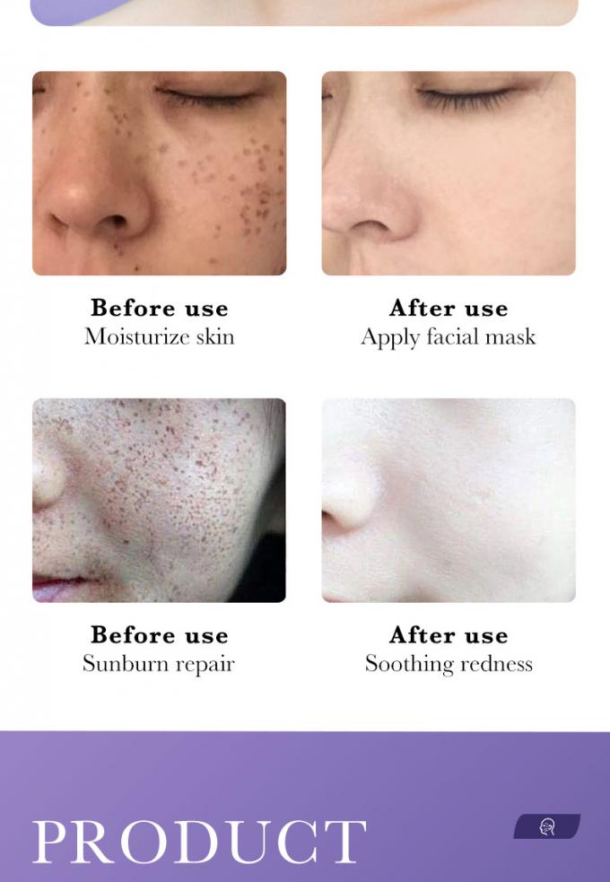 peau rayonnante Rosacea avancé 1 de rougeur pure du sérum 100% de visage de l'essence 30ml