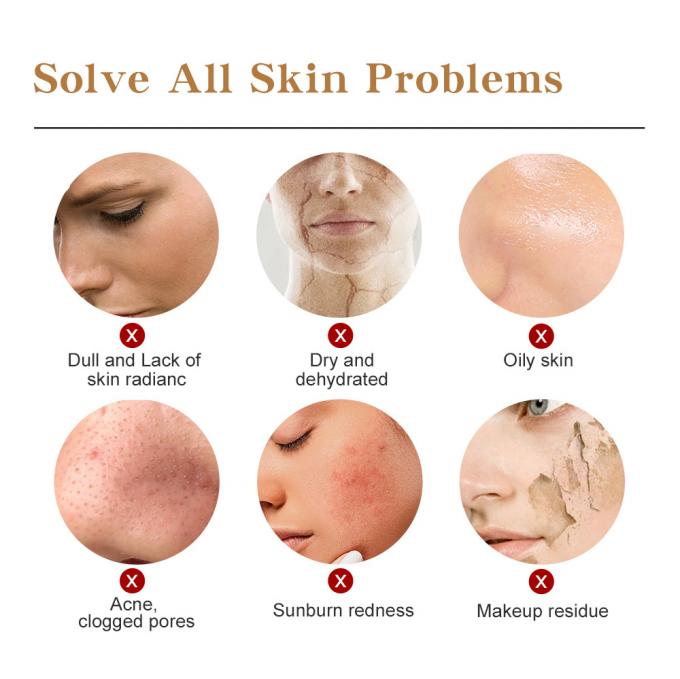 peau rayonnante Rosacea avancé 0 de rougeur pure du sérum 100% de visage de l'essence 30ml