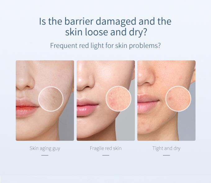 peau rayonnante Rosacea avancé 0 de rougeur pure du sérum 100% de visage de l'essence 30ml