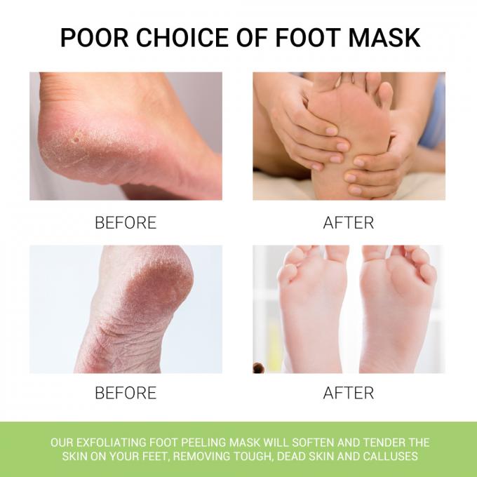épluchage sec, masque de pied