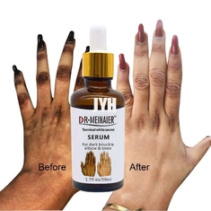 Cosmétiques de GMPC Bodycare blanchissant le sérum de lueur d'articulation de main pour enlever le coude foncé d'articulation