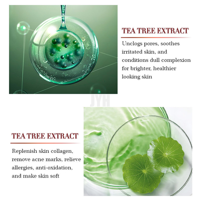 solvant organique de bouton d'acné de réparation de sérum de visage d'essence de soulagement d'arbre de thé d'OEM 1oz/30ml