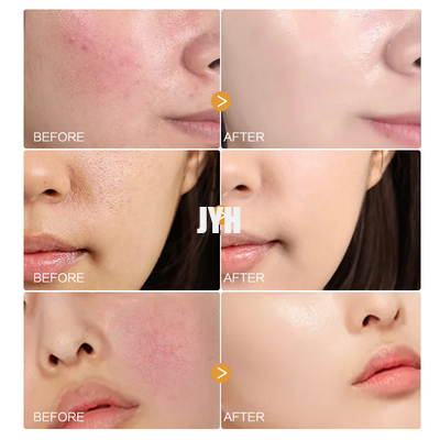 Produits de soins de la peau du visage MSDS Sérum de pétales de camomille bio Sérum facial naturel pour peau sensible