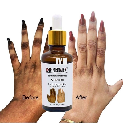 Cosmétiques de GMPC Bodycare blanchissant le sérum de lueur d'articulation de main pour enlever le coude foncé d'articulation