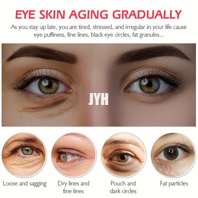 protéine de cosmétiques de l'Eyecare 20g affermissant et éclairant les lignes fines hydratant la crème d'oeil