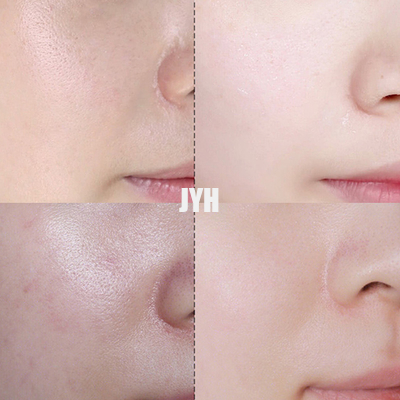 le traitement final d'acné de crème de la tache 30g éclairent et réparent la crème de visage