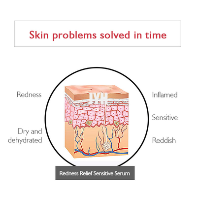 Oem Private Label Sérum anti-rougeurs biologique pour réduire les rougeurs sérum facial